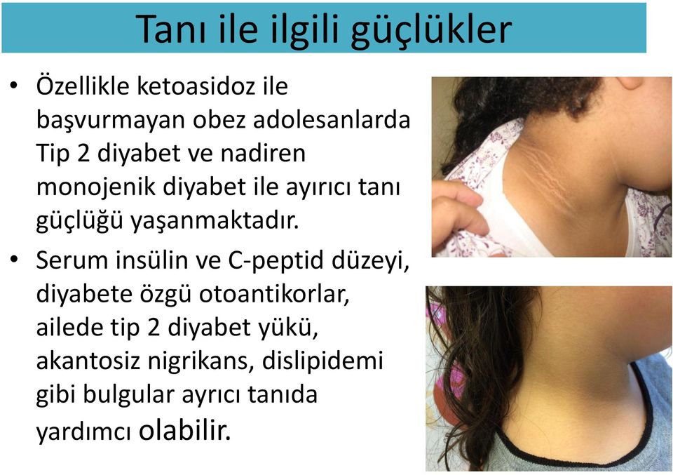 Serum insülin ve C-peptid düzeyi, diyabete özgü otoantikorlar, ailede tip 2 diyabet