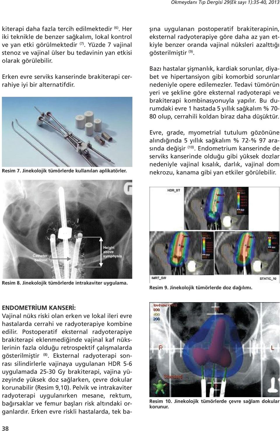 Jinekolojik tümörlerde kullanılan aplikatörler. ENDOMETRİUM KANSERİ: Vajinal nüks riski olan erken ve lokal ileri evre hastalarda cerrahi ve radyoterapiye kombine edilir.