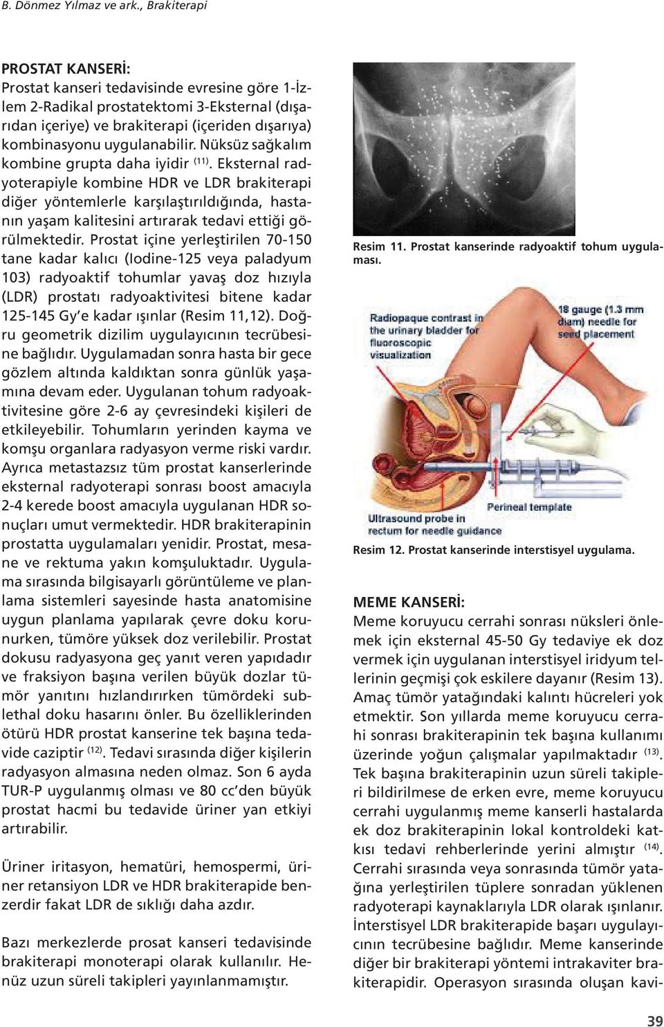 Nüksüz sağkalım kombine grupta daha iyidir (11).