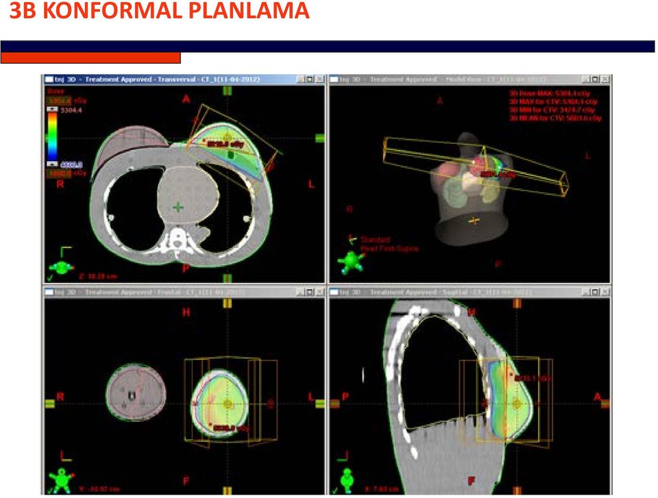 PLANLAMA