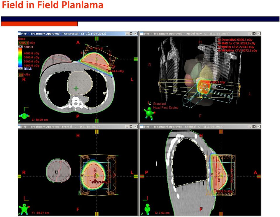 Planlama