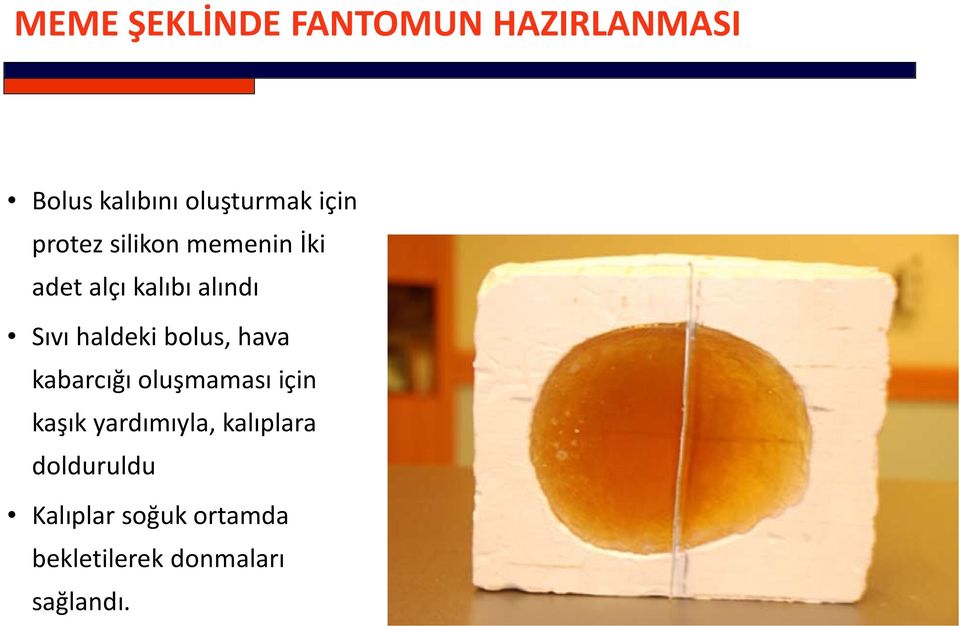 haldeki bolus, hava kabarcığı oluşmaması için kaşık yardımıyla,