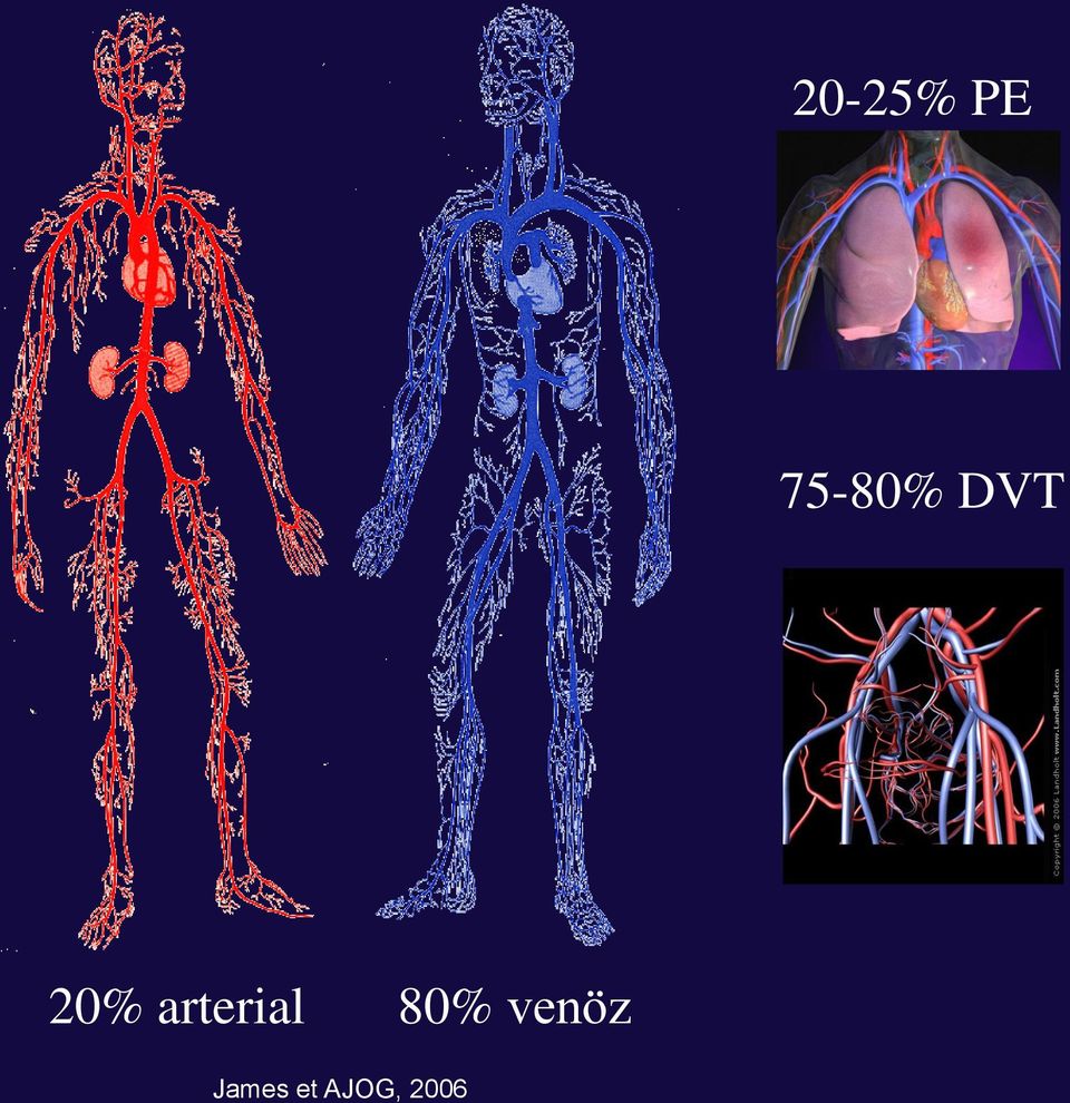 arterial 80%