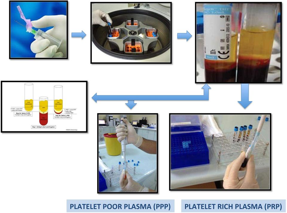 PLATELET RICH