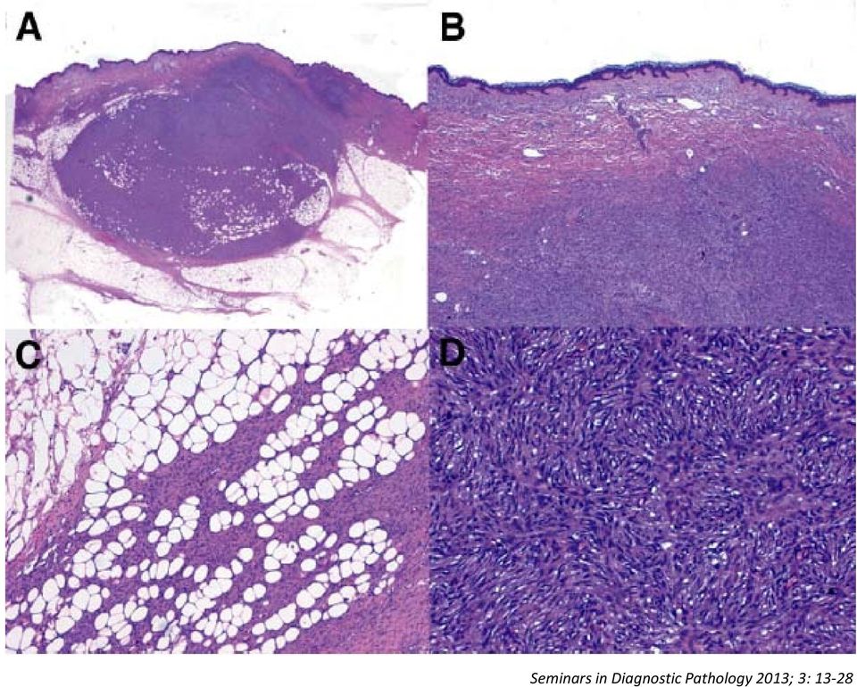 Pathology