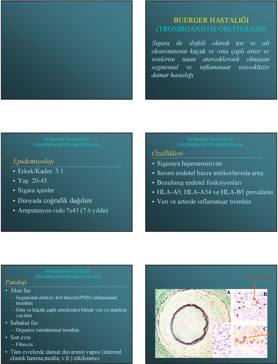 6 yılda) BUERGER HASTALIĞI Özellikleri Sigaraya hipersensitivite Serum endotel hücre antikorlarında artış Bozulmuş endotel fonksiyonları HLA-A9, HLA-A54 ve HLA-B5 prevalansı Ven ve arterde