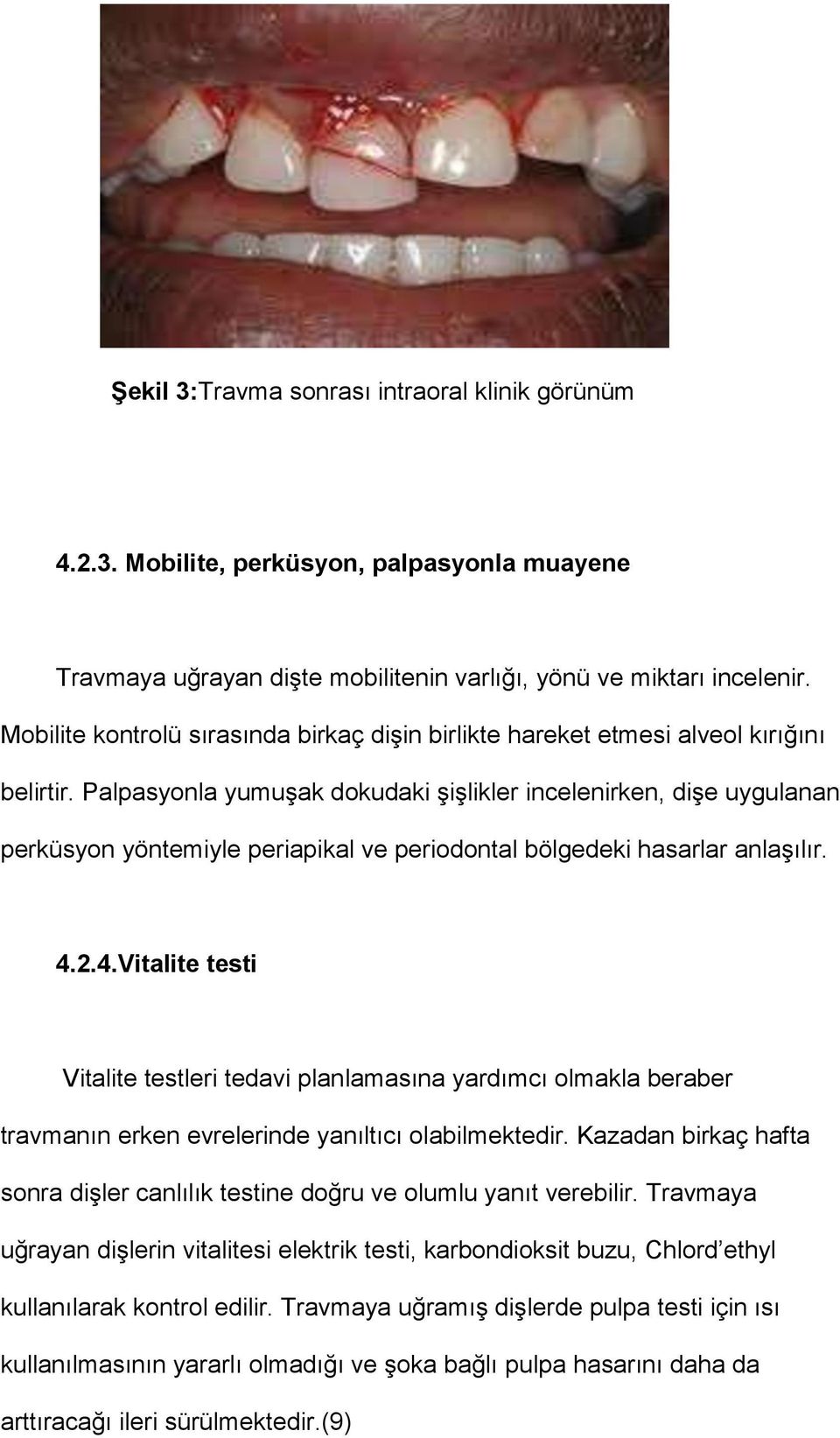 Palpasyonla yumuşak dokudaki şişlikler incelenirken, dişe uygulanan perküsyon yöntemiyle periapikal ve periodontal bölgedeki hasarlar anlaşılır. 4.