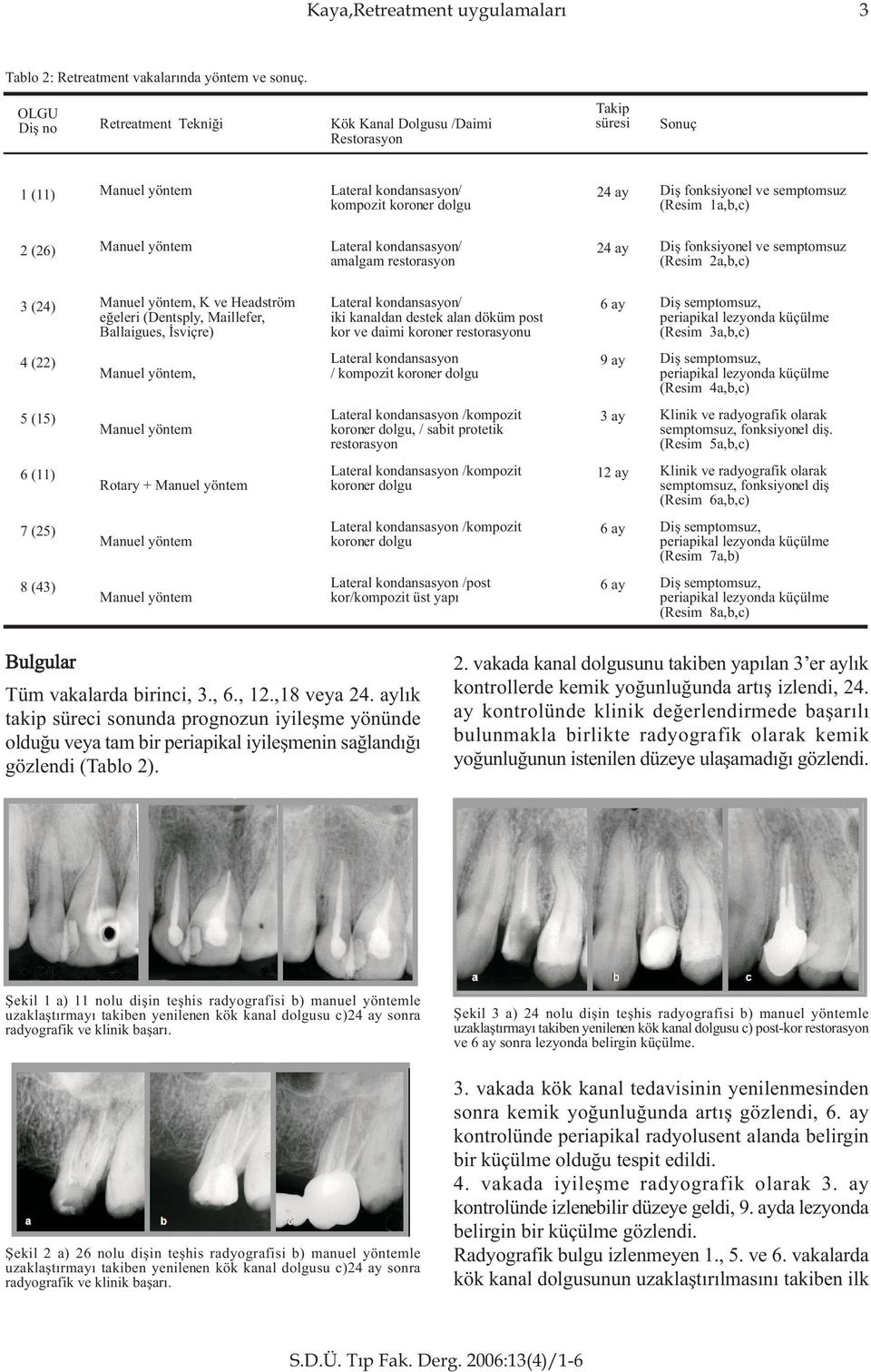 Lateral kondansasyon/ amalgam restorasyon 24 ay Diþ fonksiyonel ve semptomsuz (Resim 2a,b,c) 3 (24), K ve Headström eðeleri (Dentsply, Maillefer, Ballaigues, Ýsviçre) Lateral kondansasyon/ iki