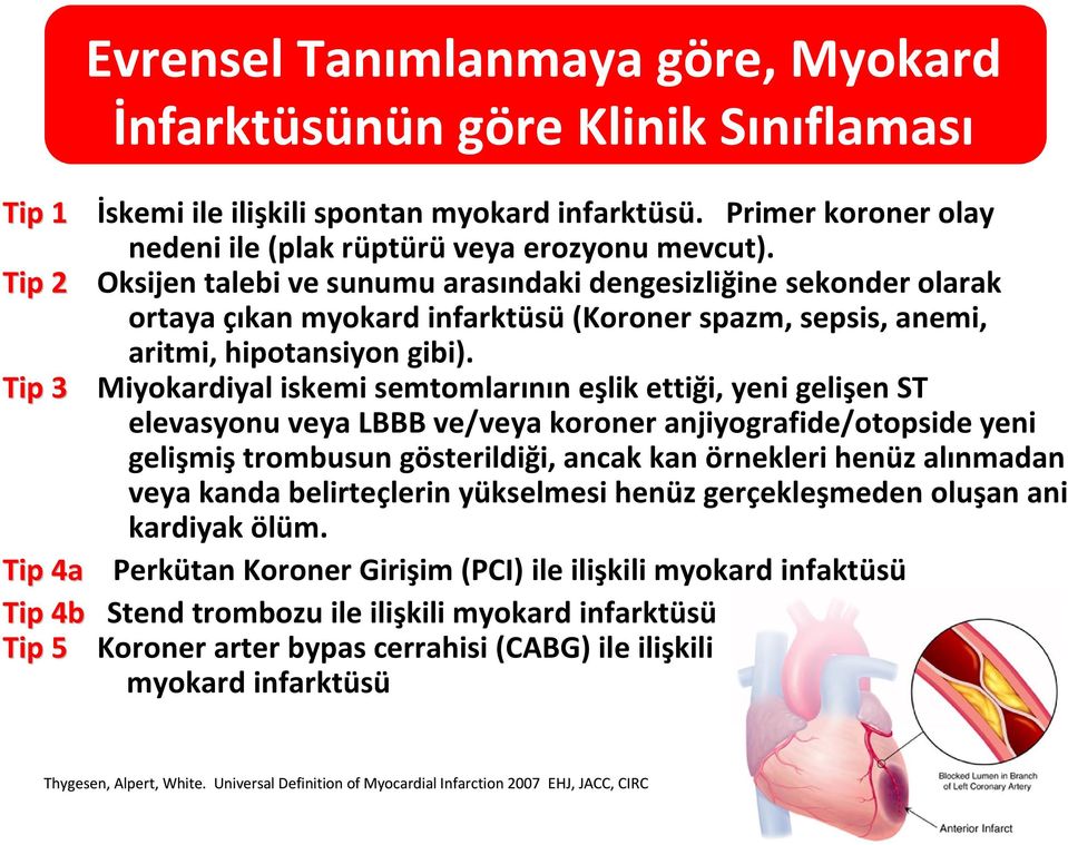 Miyokardiyal iskemi semtomlarının eşlik ettiği, yeni gelişen ST elevasyonu veya LBBB ve/veya koroner anjiyografide/otopside yeni gelişmiş trombusun gösterildiği, ancak kan örnekleri henüz alınmadan