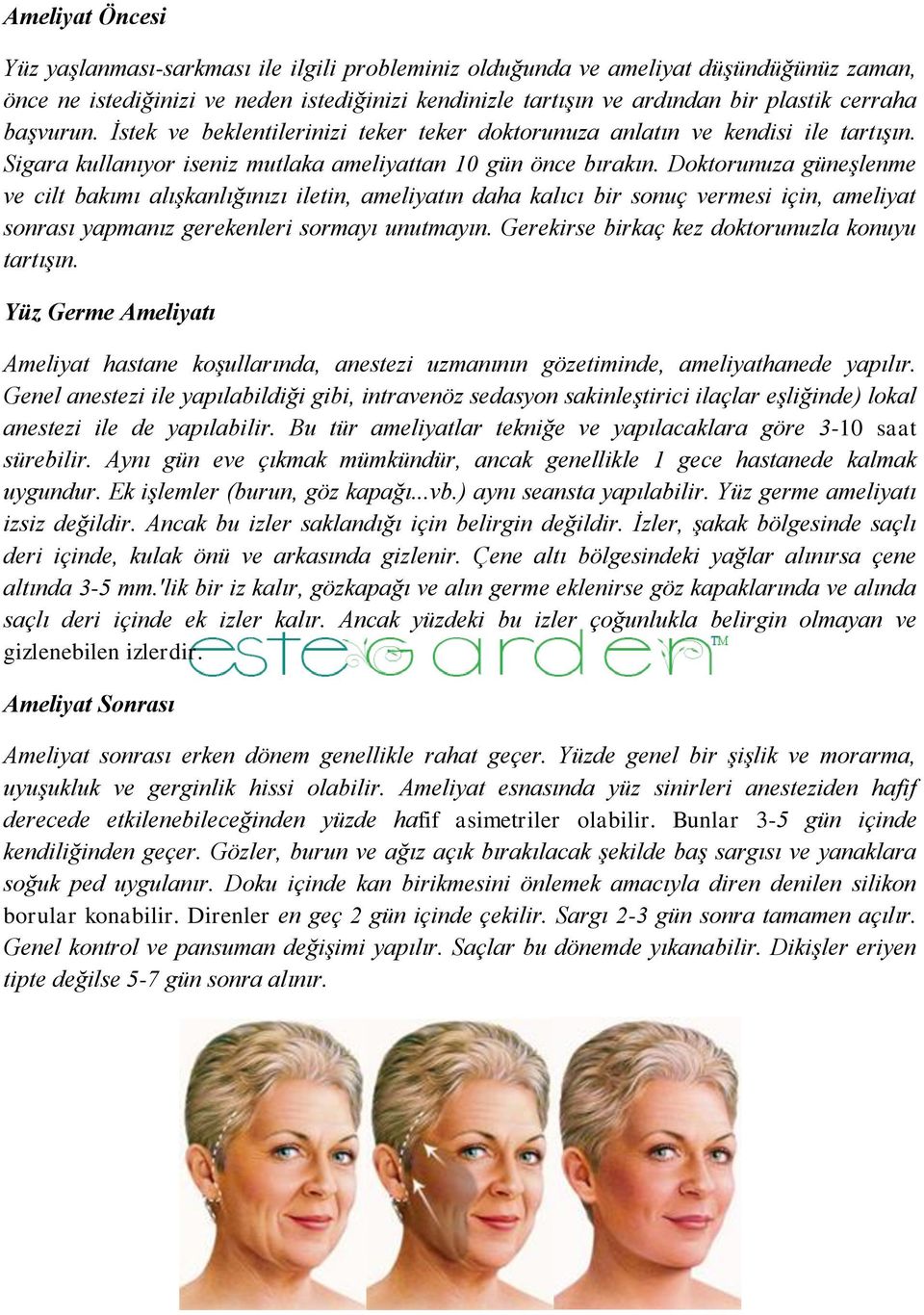 Doktorunuza güneşlenme ve cilt bakımı alışkanlığınızı iletin, ameliyatın daha kalıcı bir sonuç vermesi için, ameliyat sonrası yapmanız gerekenleri sormayı unutmayın.