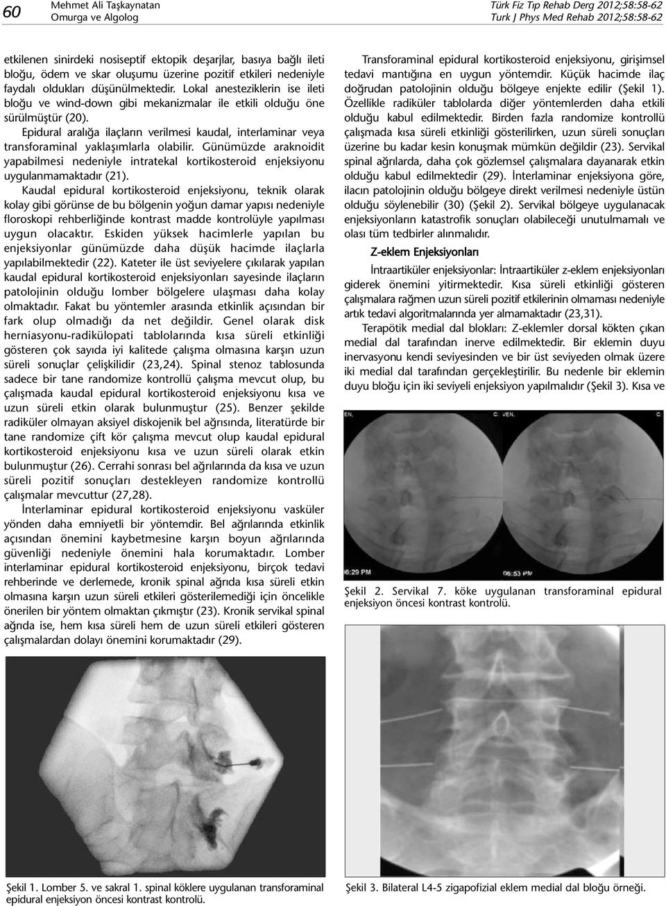 Epidural aralığa ilaçların verilmesi kaudal, interlaminar veya transforaminal yaklaşımlarla olabilir.