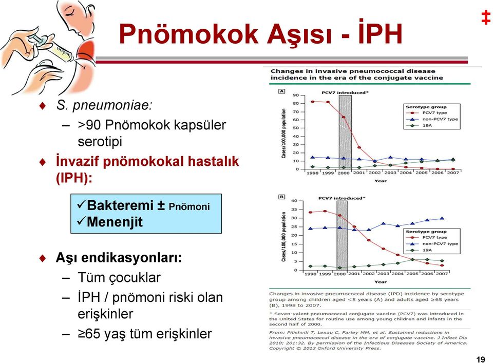 pnömokokal hastalık (IPH): Bakteremi ± Pnömoni Menenjit