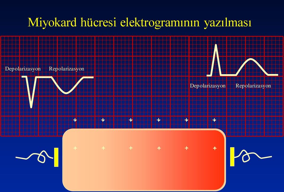 Repolarizasyon Depolarizasyon
