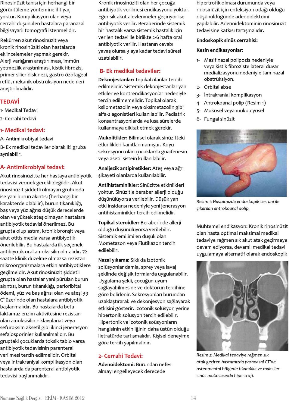 Alerji varlığının araştırılması, immün yetmezlik araştırılması, kistik fibrozis, primer silier diskinezi, gastro-özofageal reflü, mekanik obstrüksiyon nedenleri araştırılmalıdır.