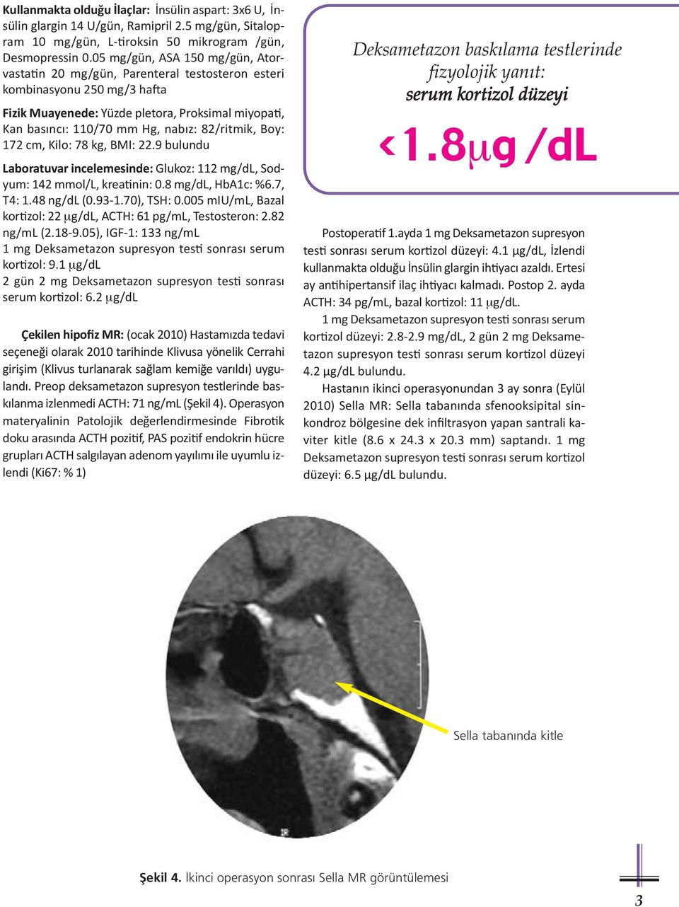 82/ritmik, Boy: 172 cm, Kilo: 78 kg, BMI: 22.9 bulundu Laboratuvar incelemesinde: Glukoz: 112 mg/dl, Sodyum: 142 mmol/l, krea nin: 0.8 mg/dl, HbA1c: %6.7, T4: 1.48 ng/dl (0.93-1.70), TSH: 0.