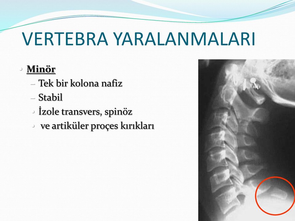 Stabil İzole transvers,