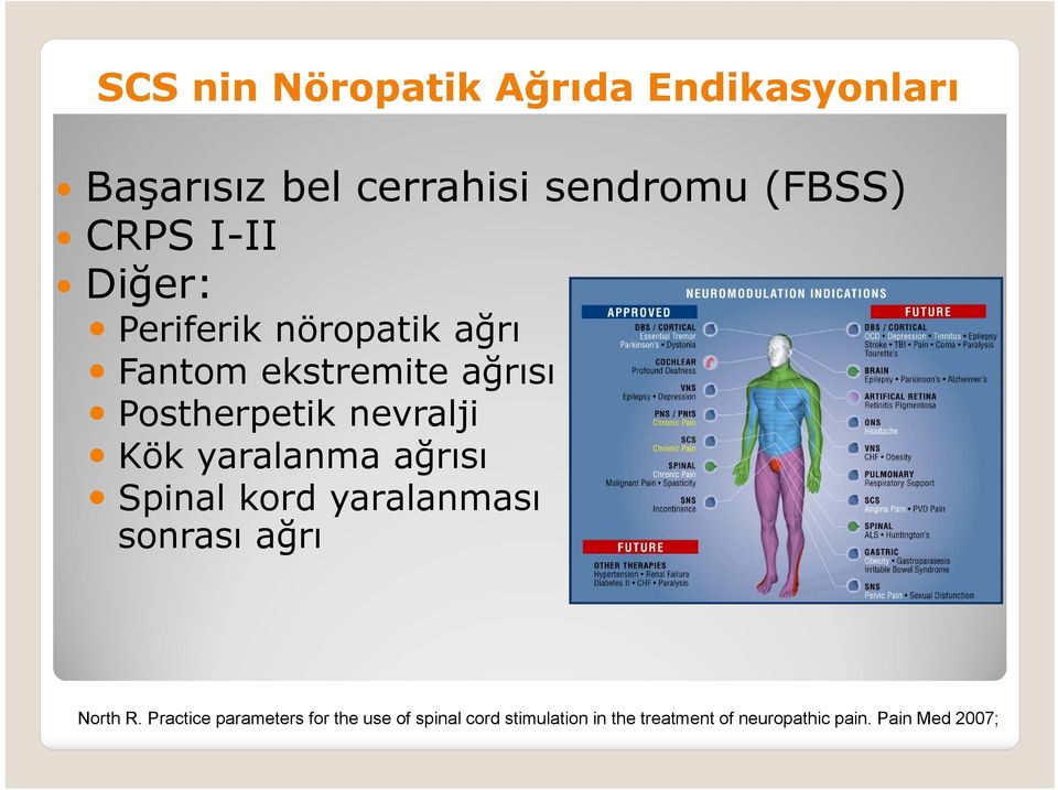 Kök yaralanma ağrısı Spinal kord yaralanması sonrası ağrı North R.