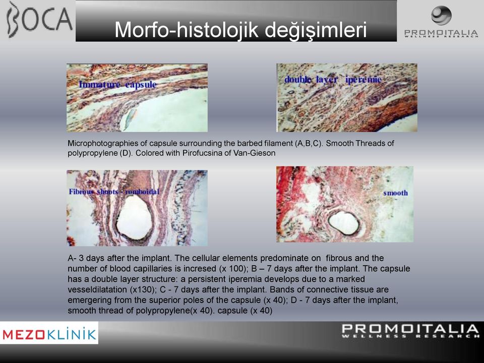 The cellular elements predominate on fibrous and the number of blood capillaries is incresed (x 100); B 7 days after the implant.