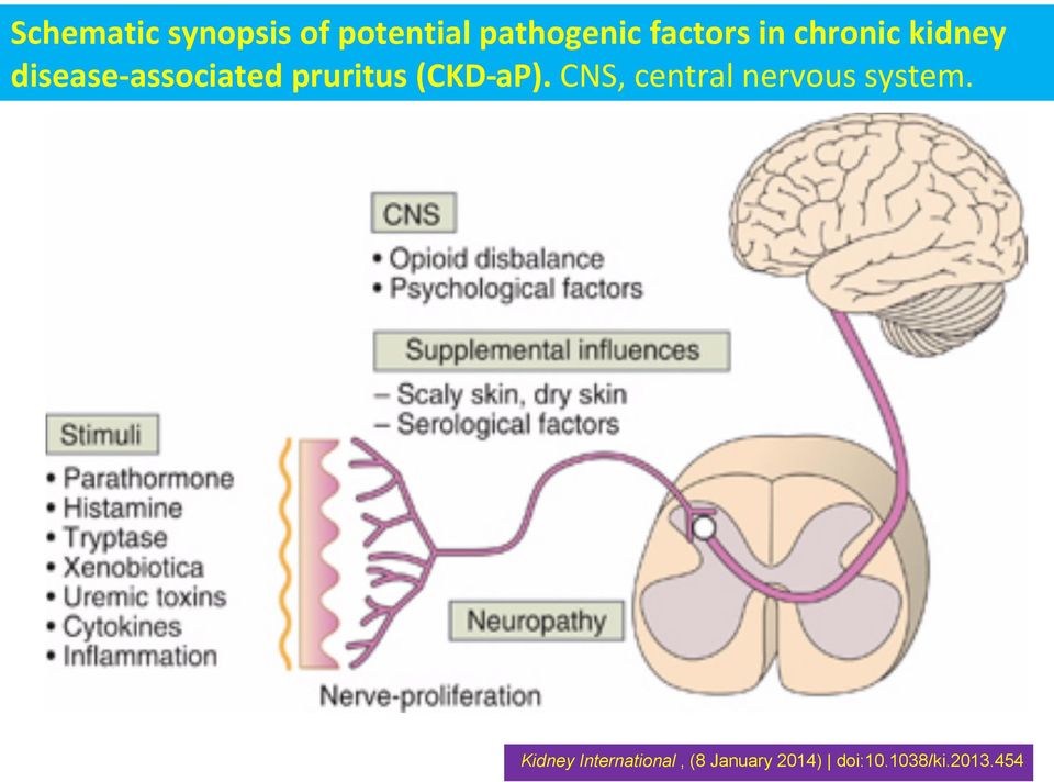 pruritus (CKD-aP). CNS, central nervous system.
