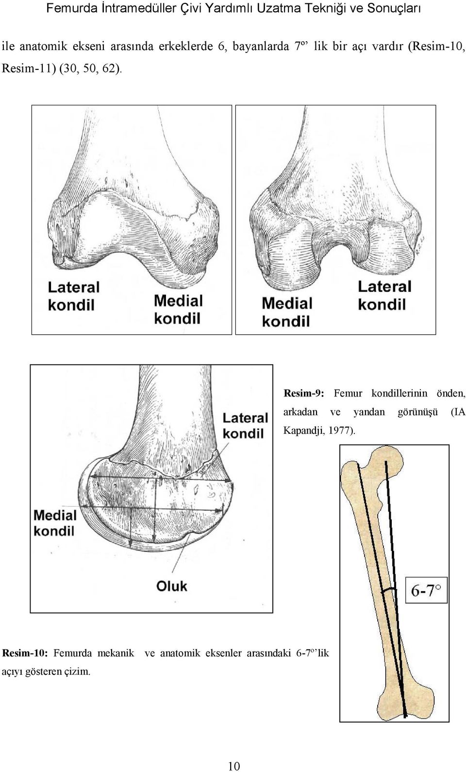 62). Resim-9: Femur kondillerinin önden, arkadan ve yandan görünüşü (IA Kapandji, 1977).