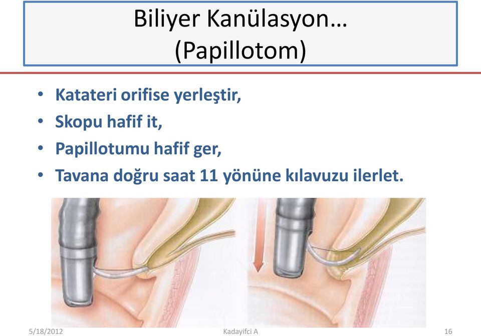 Papillotumu hafif ger, Tavana doğru saat