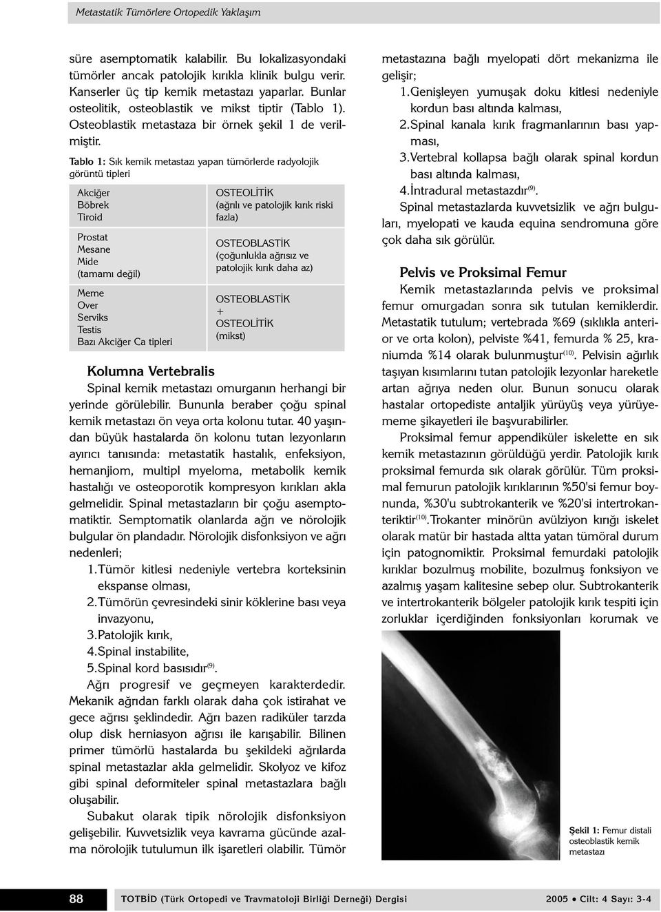 Tablo 1: Sýk kemik metastazý yapan tümörlerde radyolojik görüntü tipleri Akciðer Böbrek Tiroid Prostat Mesane Mide (tamamý deðil) Meme Over Serviks Testis Bazý Akciðer Ca tipleri OSTEOLÝTÝK (aðrýlý