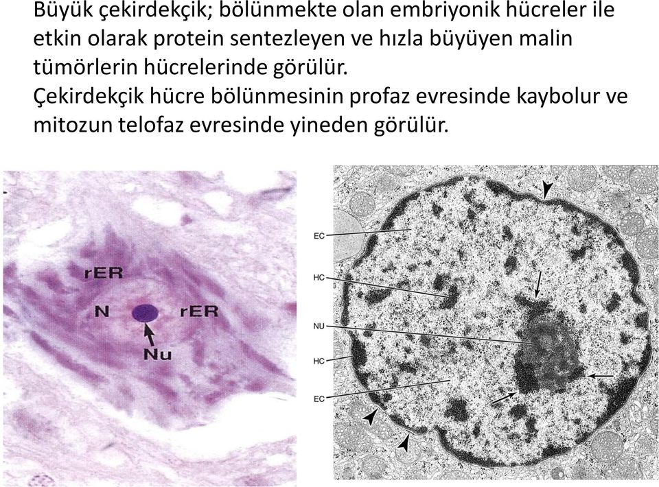 tümörlerin hücrelerinde görülür.