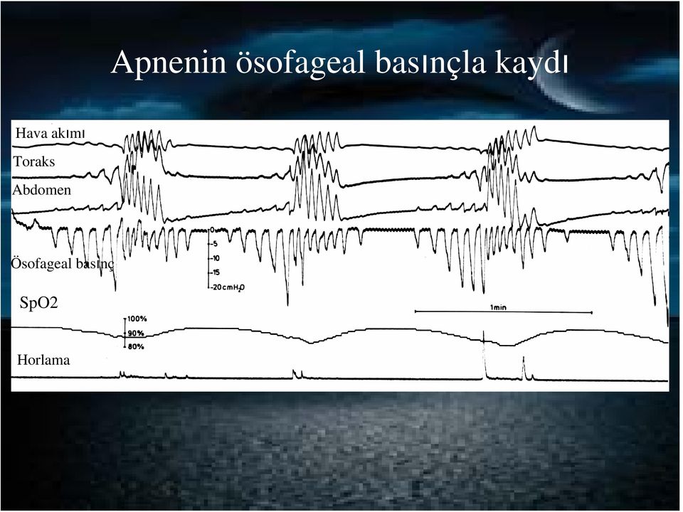 akımı Toraks Abdomen