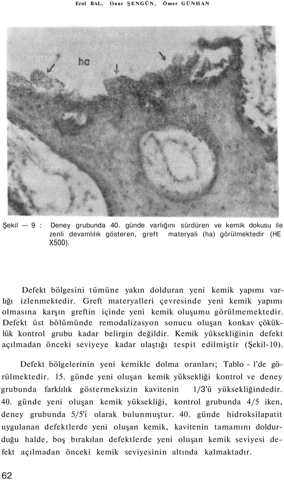 Defekt üst bölümünde remodalizasyon sonucu oluşan konkav çöküklük kontrol grubu kadar belirgin değildir.