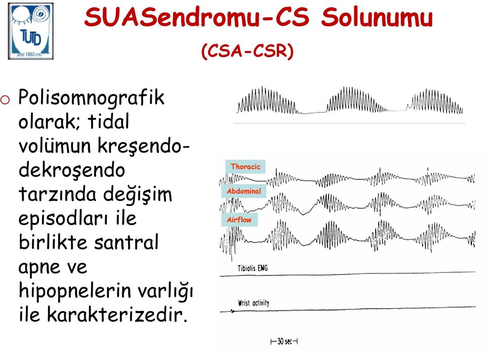 değişim episodları ile birlikte santral apne ve