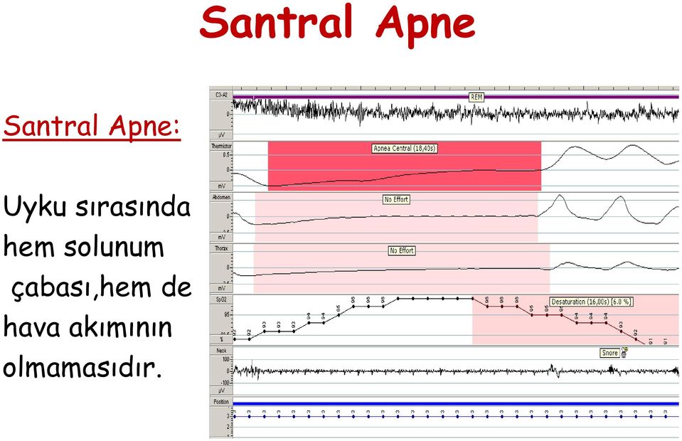 hem solunum çabası,hem