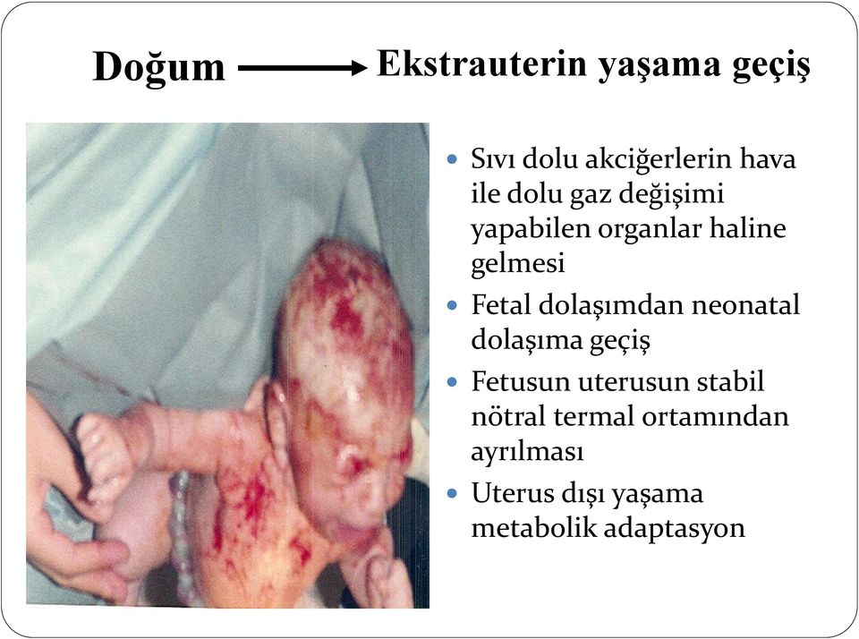 dolaşımdan neonatal dolaşıma geçiş Fetusun uterusun stabil