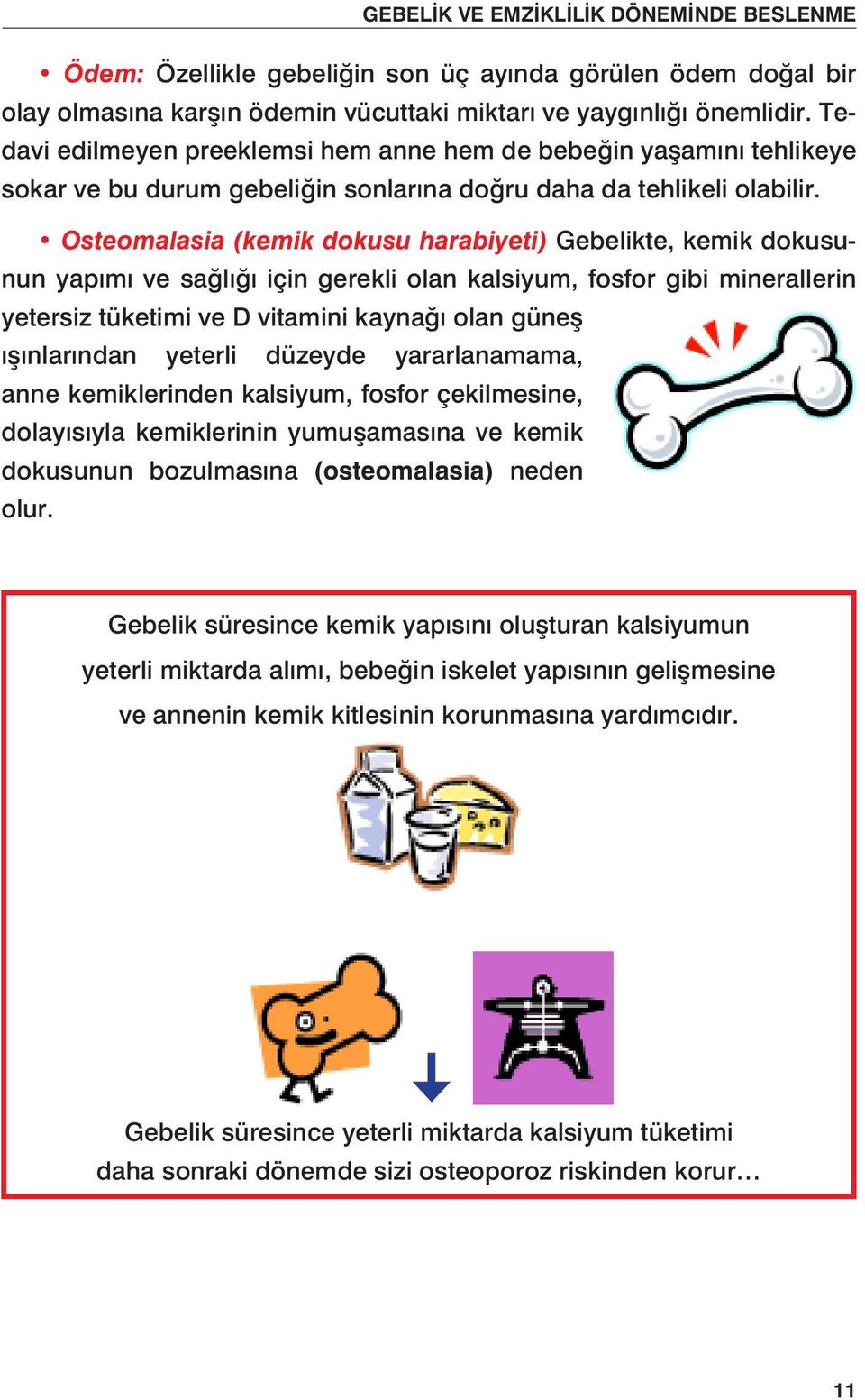 Osteomalasia (kemik dokusu harabiyeti) Gebelikte, kemik dokusunun yapımı ve sağlığı için gerekli olan kalsiyum, fosfor gibi minerallerin yetersiz tüketimi ve D vitamini kaynağı olan güneş