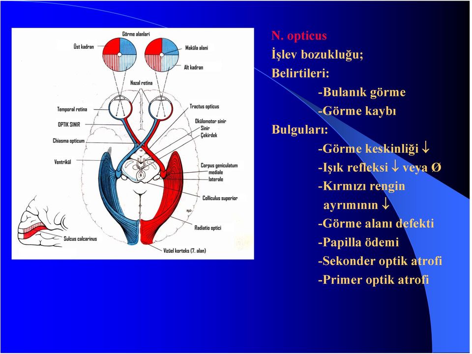 veya Ø -Kırmızı rengin ayrımının -Görme alanı defekti