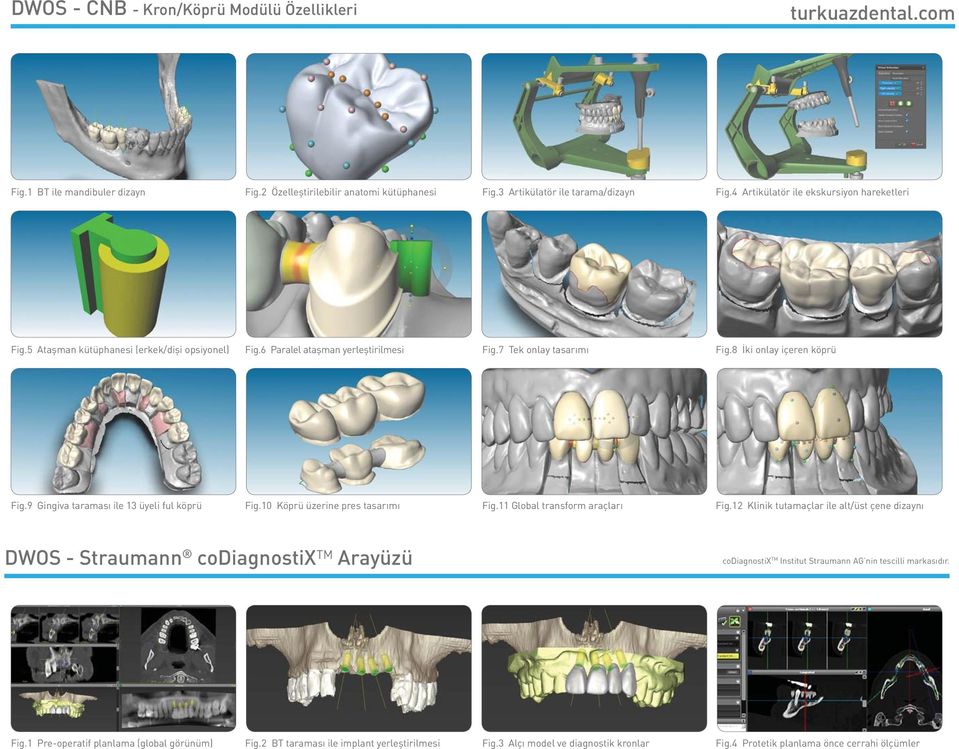 9 Gingiva taraması ile 13 üyeli ful köprü Fig.10 Köprü üzerine pres tasarımı Fig.11 Global transform araçları Fig.