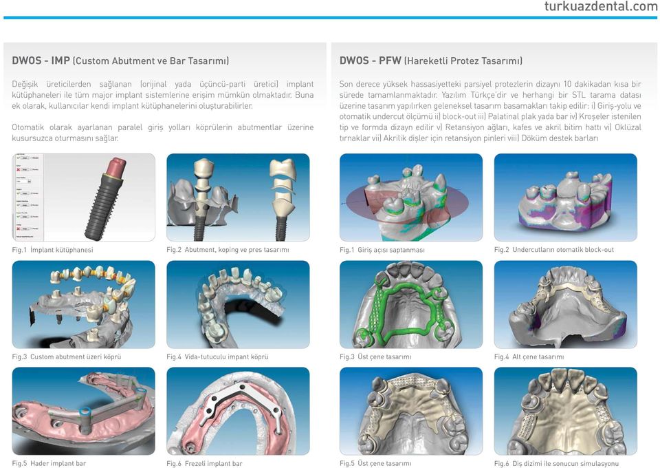 DWOS - PFW (Hareketli Protez Tasarımı) Son derece yüksek hassasiyetteki parsiyel protezlerin dizaynı 10 dakikadan kısa bir sürede tamamlanmaktadır.