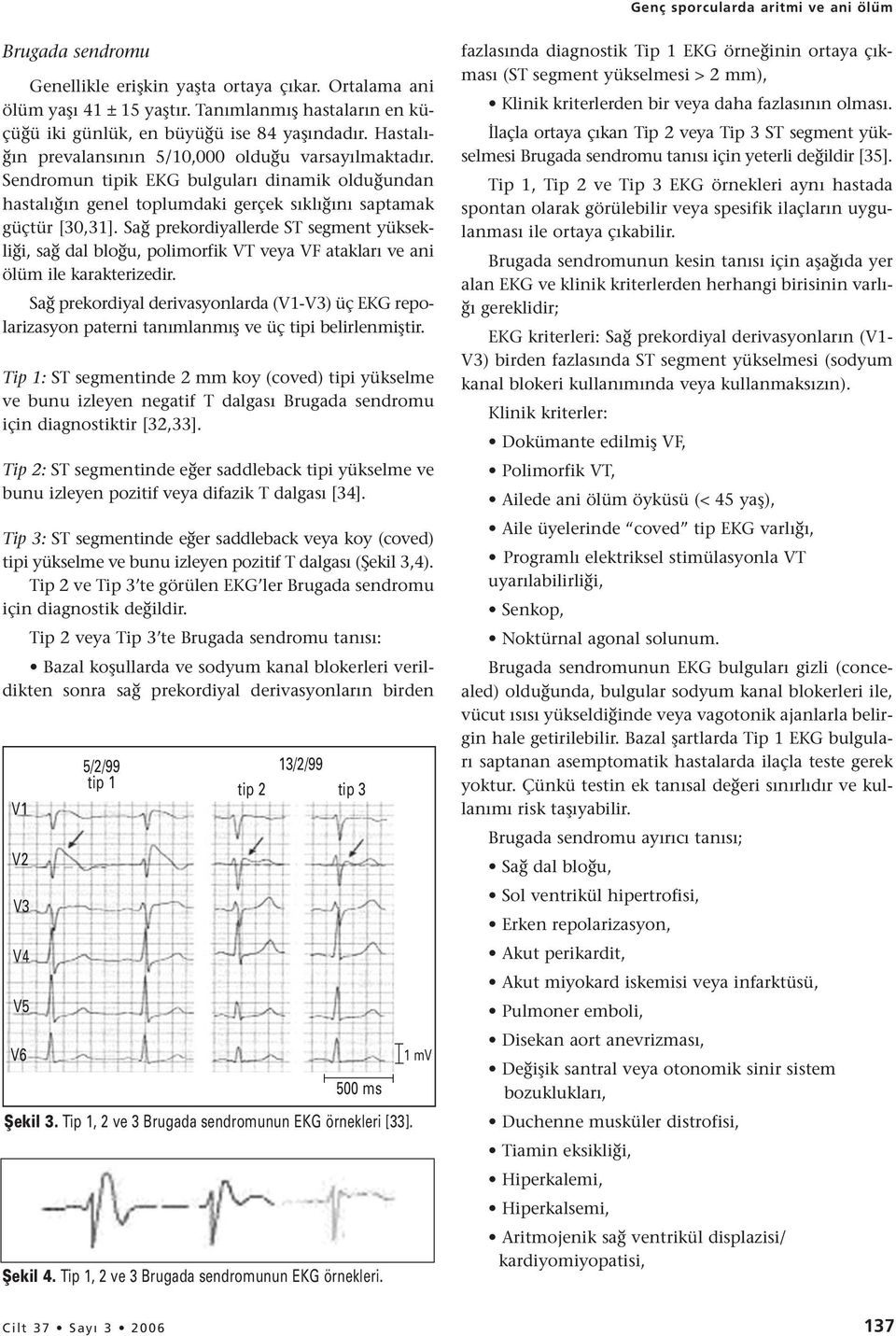 Sendromun tipik EKG bulguları dinamik olduğundan hastalığın genel toplumdaki gerçek sıklığını saptamak güçtür [30,31].