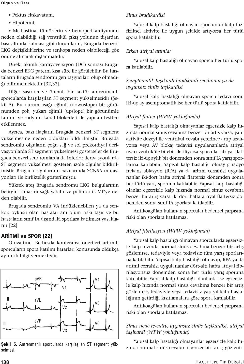 Bu hastaların Brugada sendromu gen taşıyıcıları olup olmadığı bilinmemektedir [32,33]. Diğer saşırtıcı ve önemli bir faktör antrenmanlı sporcularda karşılaşılan ST segment yükselmesidir (Şekil 5).