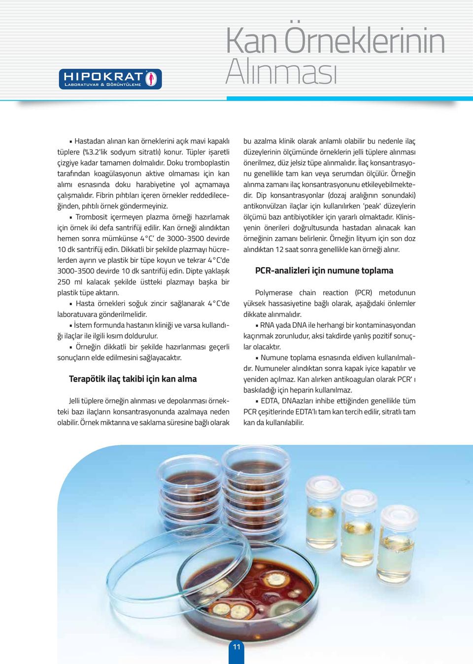 Fibrin pıhtıları içeren örnekler reddedileceğinden, pıhtılı örnek göndermeyiniz. Trombosit içermeyen plazma örneği hazırlamak için örnek iki defa santrifüj edilir.