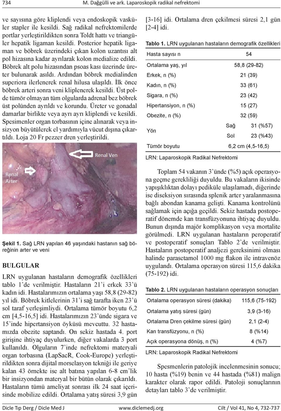 Posterior hepatik ligaman ve böbrek üzerindeki çıkan kolon uzantısı alt pol hizasına kadar ayrılarak kolon medialize edildi. Böbrek alt polu hizasından psoas kası üzerinde üreter bulunarak asıldı.