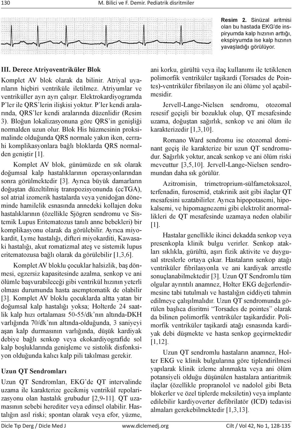 Elektrokardiyogramda P ler ile QRS lerin ilişkisi yoktur. P ler kendi aralarında, QRS ler kendi aralarında düzenlidir (Resim 3). Bloğun lokalizasyonuna göre QRS in genişliği normalden uzun olur.