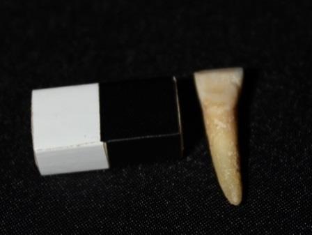 Zeytinli Ada İnsan İskeletlerinde Diş Varyasyonları Fleksiyon varyasyonu için üst çenede 223 ve alt çenede 190 olmak üzere toplam 413 tane diş ve diş soketi incelenmiştir.
