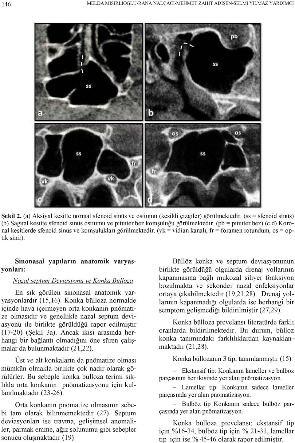 (vk = vidian kanalı, fr = foramen rotundum, os = optik sinir).