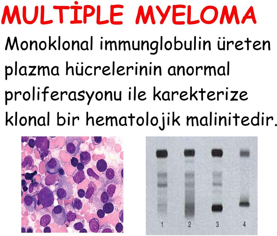 hücrelerinin anormal proliferasyonu