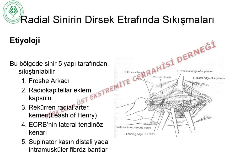 Radiokapitellar eklem kapsülü 3.