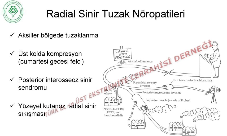 (cumartesi gecesi felci) Posterior