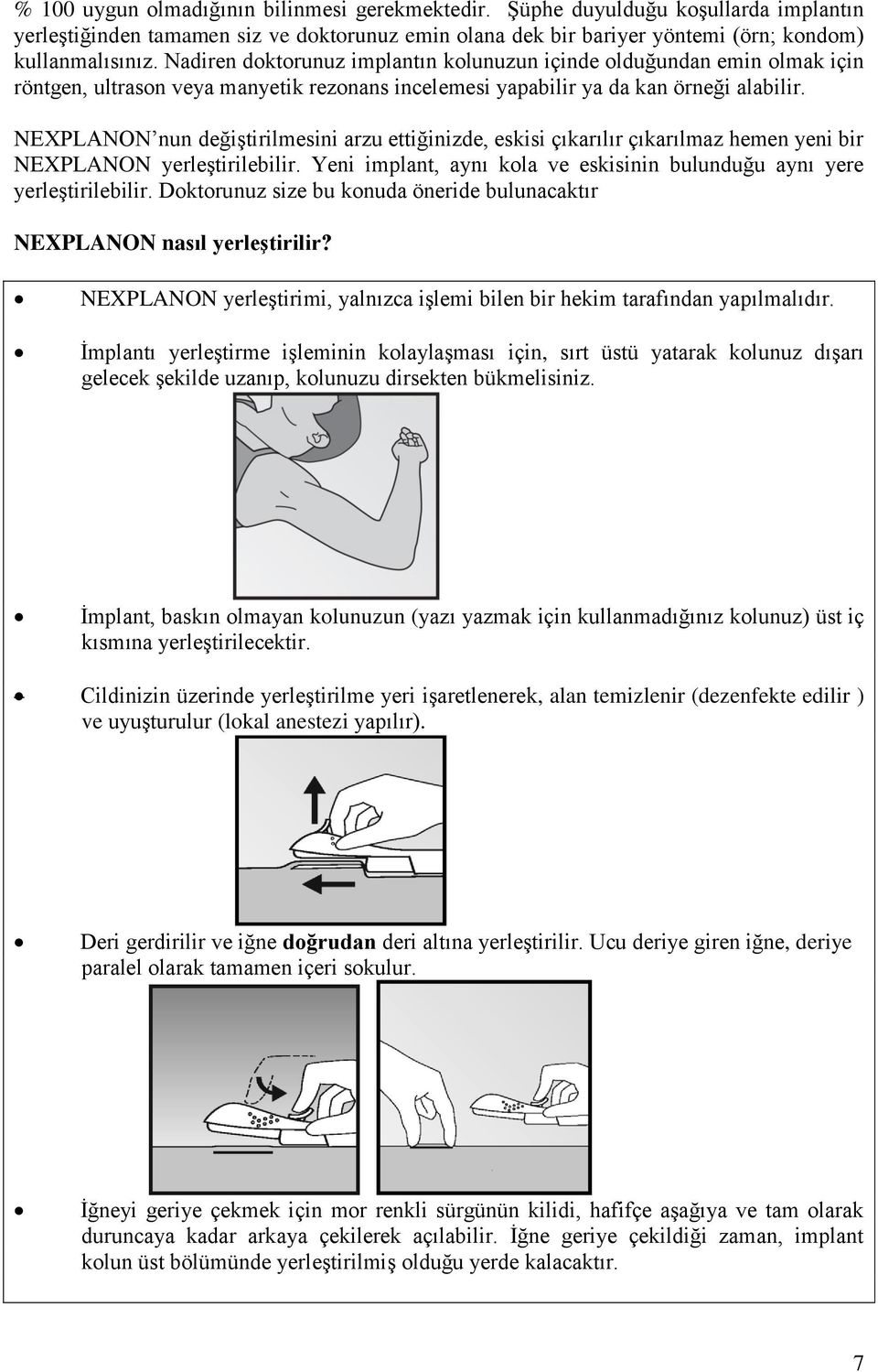 NEXPLANON nun değiştirilmesini arzu ettiğinizde, eskisi çıkarılır çıkarılmaz hemen yeni bir NEXPLANON yerleştirilebilir. Yeni implant, aynı kola ve eskisinin bulunduğu aynı yere yerleştirilebilir.