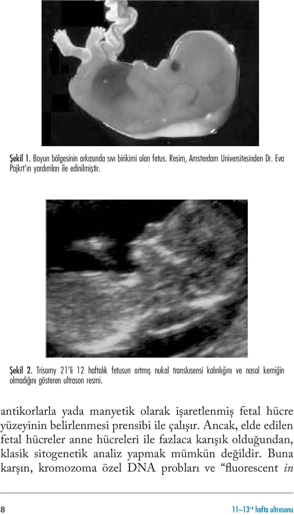 antikorlarla yada manyetik olarak işaretlenmiş fetal hücre yüzeyinin belirlenmesi prensibi ile çalışır.