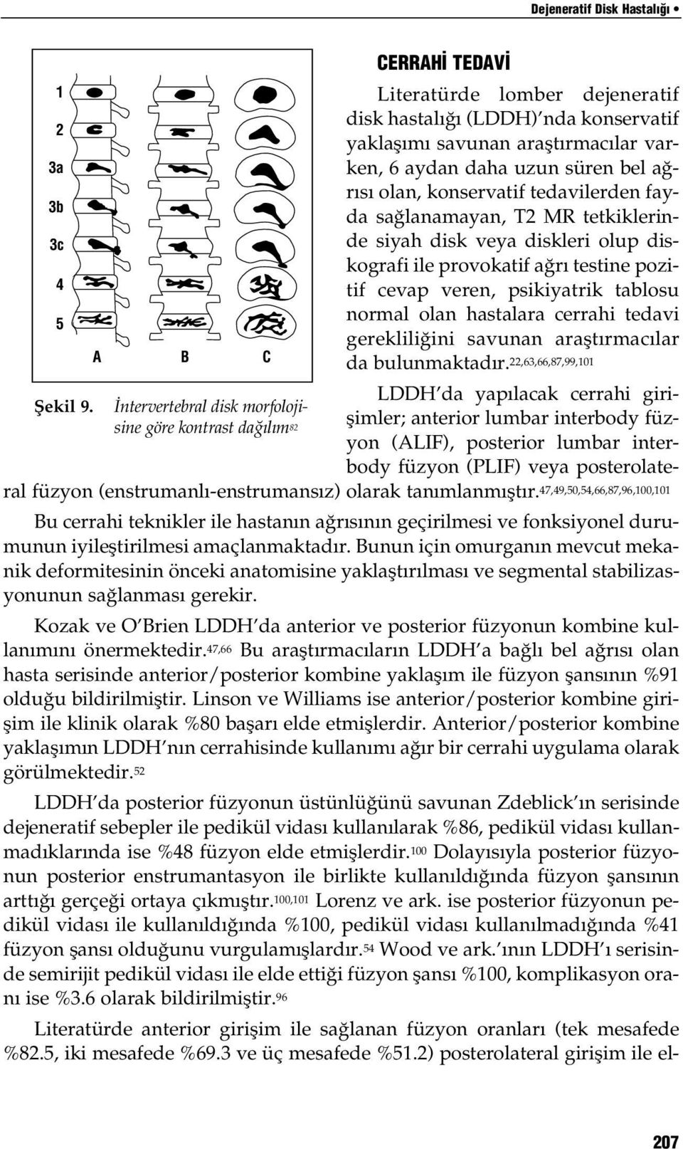 hastalara cerrahi tedavi 5 gerekliliğini savunan araştırmacılar A B C da bulunmaktadır. 22,63,66,87,99,101 LDDH da yapılacak cerrahi girişimler; anterior lumbar interbody füz- fiekil 9.