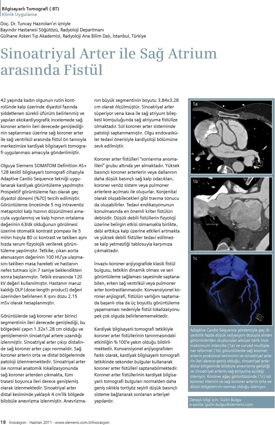 Fistül 42 yaşında kadın olgunun rutin kontrolünde kalp üzerinde diyastol fazında şiddetlenen sürekli üfürüm belirlenmiş ve yapılan ekokardiyografik incelemede sağ koroner arterin ileri derecede